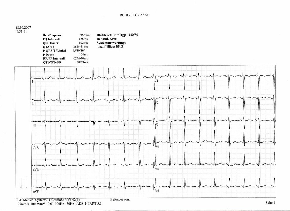 Electrocardiogramm